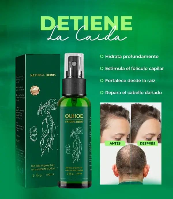 HairVita™|Ouhoe Tonico Para El Crecimiento Capilar